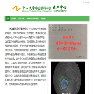 ZIRC 读片中心-中山大学中山眼科中心 Image Reading Center ZHONGSHAN
OPHTHALMIC CENTER, SUN YAT-SEN UNIVERSITY ZIRC 读片中心-中山大学中山眼科中心 Image Reading Center ZHONGSHAN
OPHTHALMIC CENTER, SUN YAT-SEN UNIVERSITY